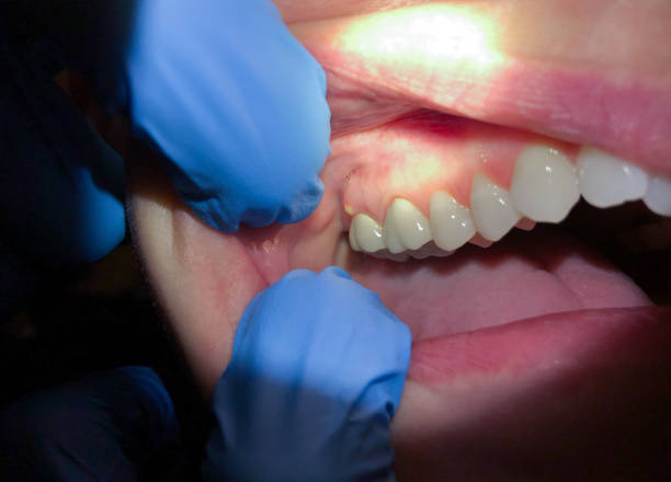 Best Tooth Pain Emergency Relief  in Marion, KS