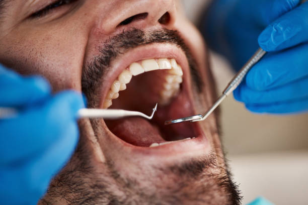 Best Emergency Tooth Extraction  in Marion, KS